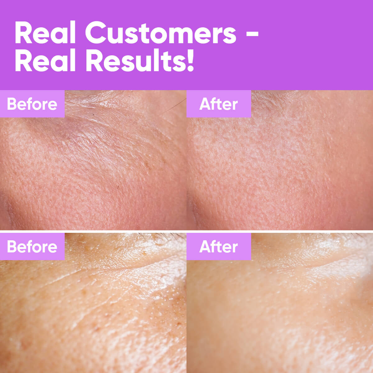 Youth Concentrate Serum