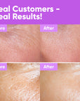 Youth Concentrate Serum