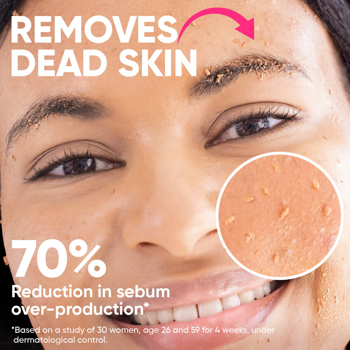 ame pure peels so good, chemical peeling, chemical peel,  aha, bha, fruit a cid, smooth skin peelilng, enyzme scrub, oily skin, acne removal