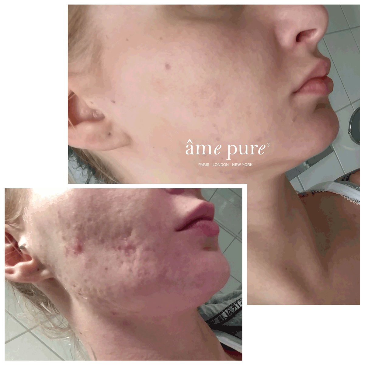 CIT Face Roller PLATINUM