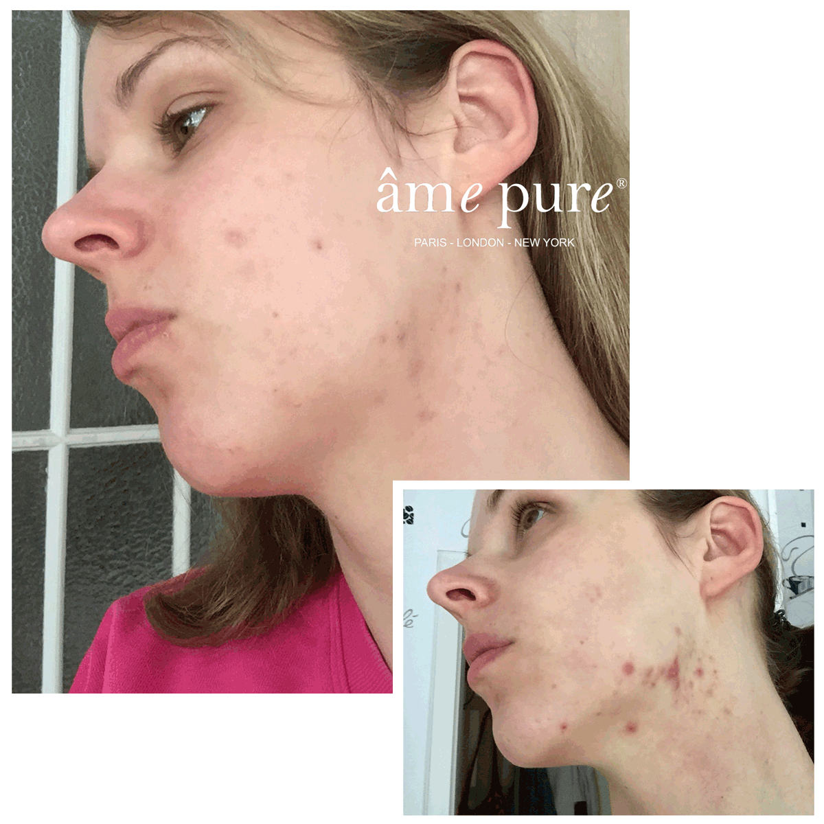 CIT Face Roller PLATINUM