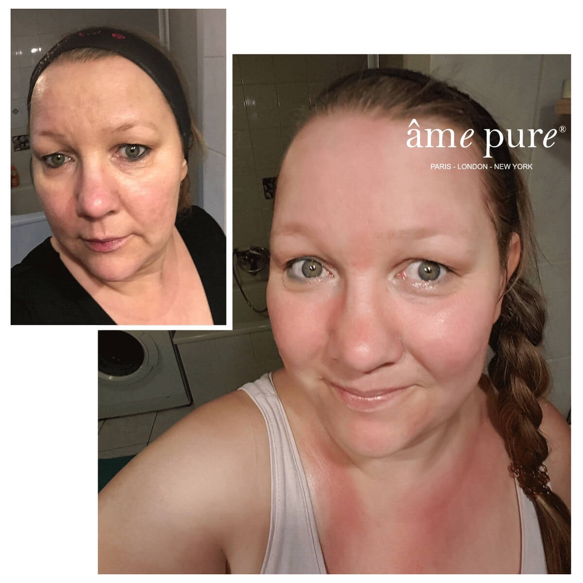 WrinklEraser™ BASIC