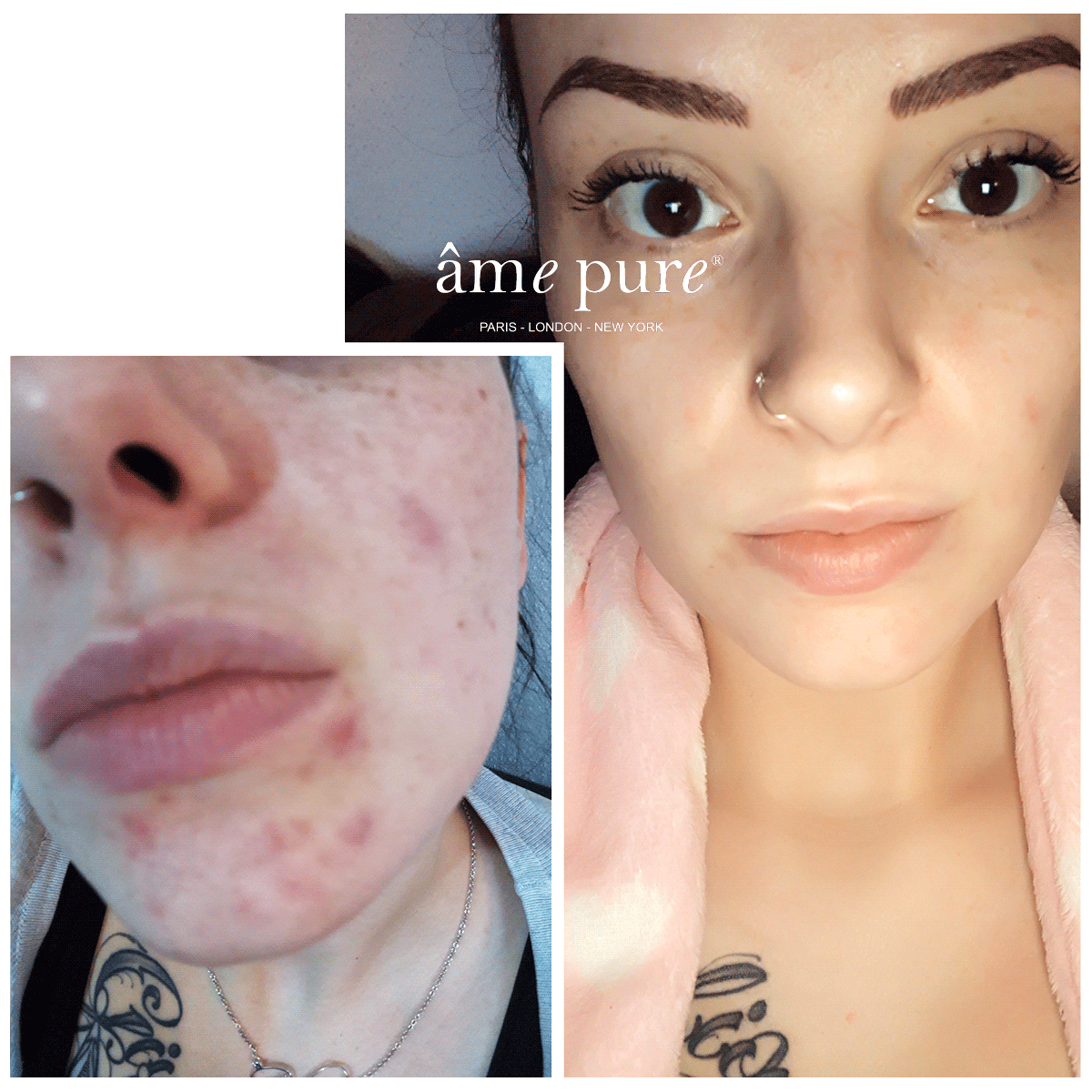 CIT Face Roller PLATINUM