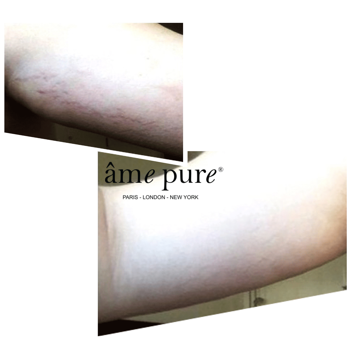 Body Basic | Stretch Marks - Buy 1 Get 1 Free